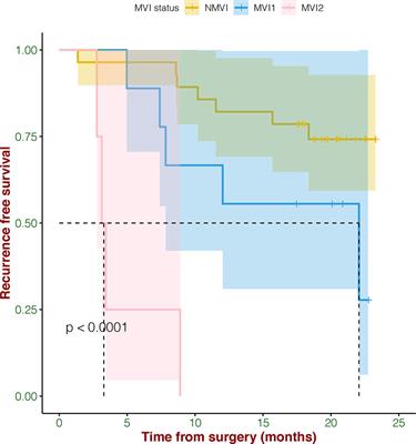 Cancer Genomic Alterations Can Be Potential Biomarkers Predicting Microvascular Invasion and Early Recurrence of Hepatocellular Carcinoma